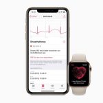 في أوروبا مع التحديث watchOS 5.2 لـ Apple Watch 4 أضاف دعمًا لتخطيط القلب