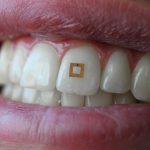 New level of telemedicine: sensors on teeth, smart lenses and assistant for Alzheimer's patients