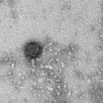 See what a new coronavirus looks like under a microscope