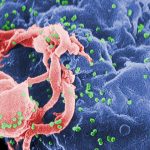 A case of probable HIV cure without treatment is told