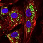 Îmbătrânirea celulelor umane poate fi suspendată de nanoparticule