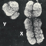 The male Y chromosome affects more than just the genitals. We tell about the opening