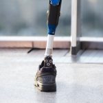 How modern prostheses are made in Russia and abroad