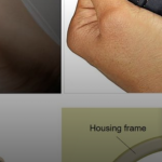 New sensors can be printed directly on human skin