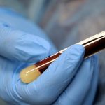 Des anticorps contre le coronavirus trouvés même chez les personnes qui n'étaient pas malades