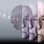 Oamenii de știință au descoperit modul în care munca fizică afectează apariția demenței senile