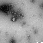 Prima imagine a tulpinii de virus britanic capturată