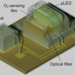 The microimplant measures the oxygen level in the tissues deep under the skin in real time