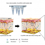 Microneedle ice patches deliver drugs and then melt
