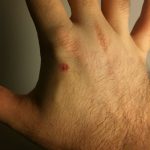 All data in a cylinder under the skin: how people implant chips in themselves and what they are for