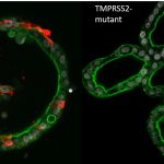Biologists show how coronavirus infects human intestinal organelles