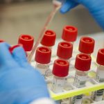 A test has been created in Russia to determine the effectiveness of antibodies to coronavirus