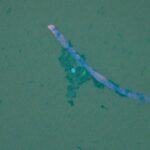 Dangerous pathogens 'travel' on microplastics and easily enter the ocean