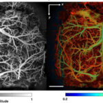 Technology developed for ultra-fast scanning of brain vessels with high resolution