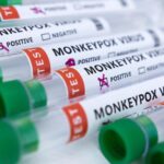 Four places you are most likely to contract monkeypox