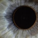 Electrostimulation of the eyes proved to be a treatment for depression