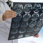 Three Easy Ways to Avoid a Brain Tumor