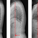 Scientists link poor posture to mental decline