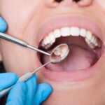 Scientifically Proven: Poor Oral Hygiene Leads to Pneumonia