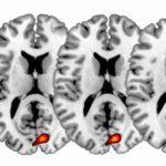 Sarcina provoacă schimbări dramatice în creier: oamenii de știință au explicat care dintre ele