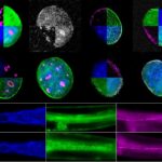 "Quality Control Service" inside cells prevents aging