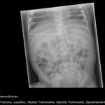 AI "failed" the exam in radiology: people are still better at analyzing images