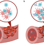 Engineers figured out how to stop severe internal bleeding
